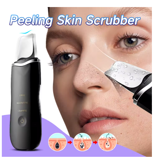 Electric Skin Scrubber Peeling Blackhead Remover Deep Face Cleaning Lifting Ion Acne Pore Cleaner Facial Spatula Shovel Cleanser