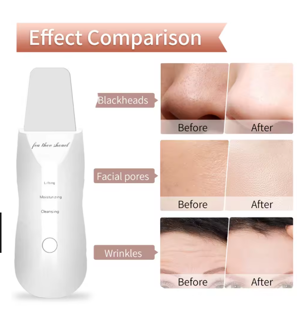 Electric Skin Scrubber Peeling Blackhead Remover Deep Face Cleaning Lifting Ion Acne Pore Cleaner Facial Spatula Shovel Cleanser